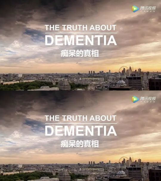 痴呆的真相 The Truth About Dementia (2016)